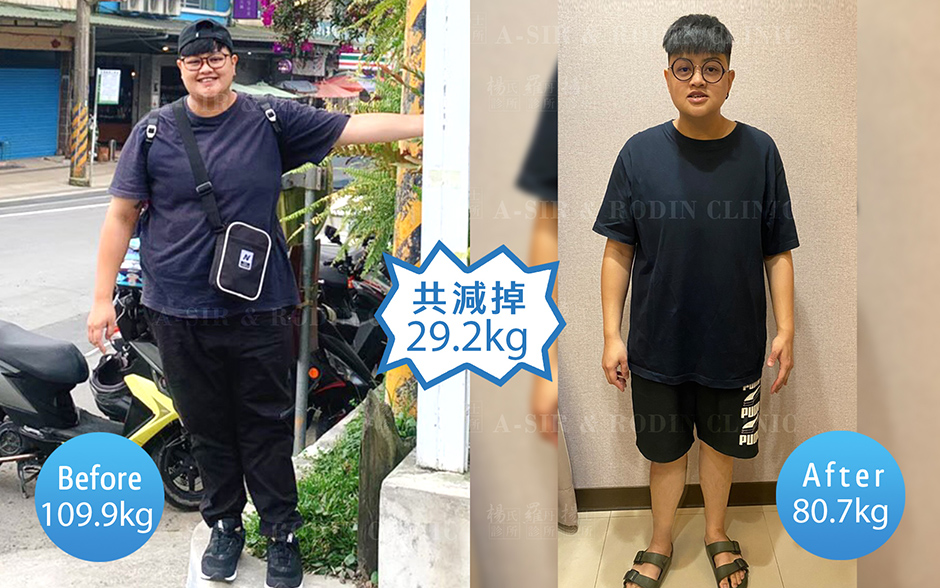 減重 減肥 瘦身 肥胖